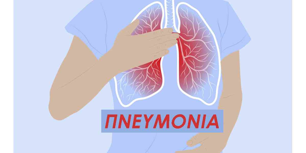 πνευμονία, συμπτώματα πνευμονίας, λειτουργία πνευμόνων, αιτίες πνευμονίας, επιπλοκές πνευμονίας, θεραπεία πνευμονίας, πρόληψη πνευμονίας, παράγοντες κινδύνου για πνευμονία, ποια άτομα έχουν υψηλότερο κίνδυνο να νοσήσουν με πνευμονία , ενίσχυση του ανοσοποιητικού
